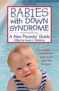 Babies with Down Syndrome: A New Parents' Guide book cover
