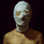 a photo of a person with gauze wrapped around their face and bandaids over their eyes
